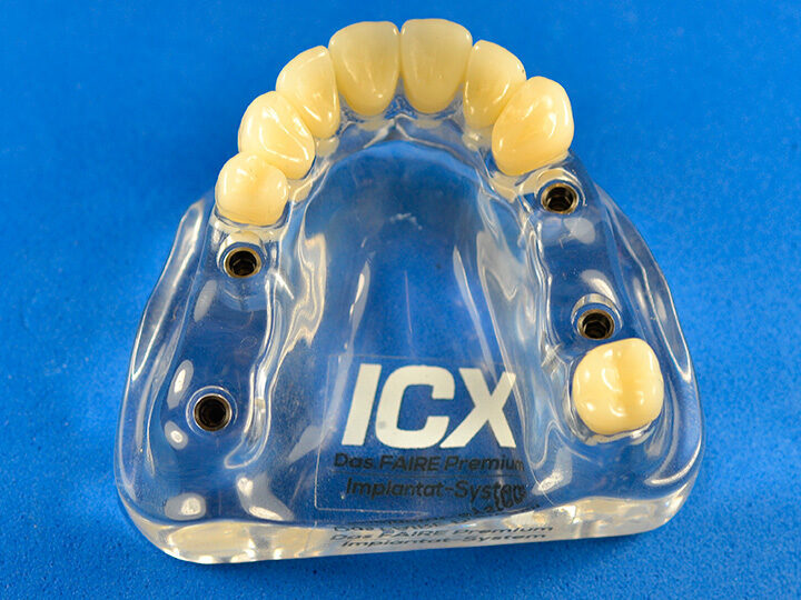 Plexiglas Modell mit ICX-Modellanalogen | 377912