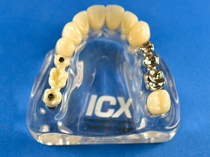 Plexiglas Modell mit Restauration | 377916