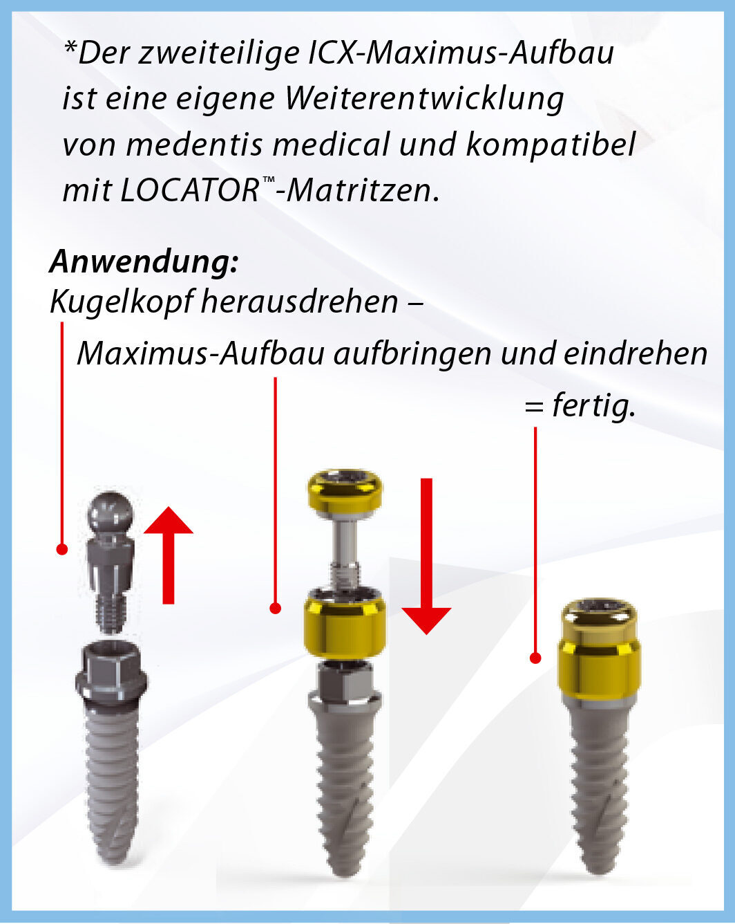 ICX-Maximus–Aufbau 2-tlg (Verbindungsschraube inkl.) | 377433