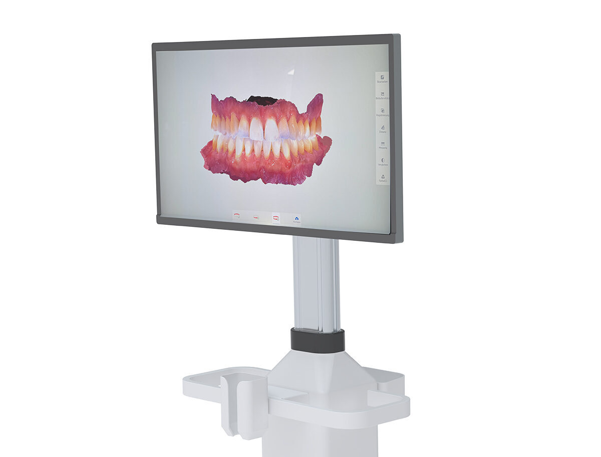 ICX-BAMBOO PRO – MOBILE STATION FÜR ICX-P5 INTRAORAL SCANNER (RATENZAHLUNG) | 380422