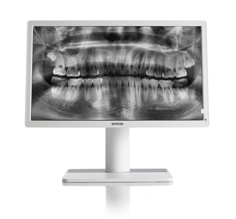 Barco Befundungsmonitor Nio Color 2MP MDNC-2123DEWH | 373773