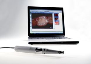 Dürr Vistacam digital mit Fingerschaltung | 375627