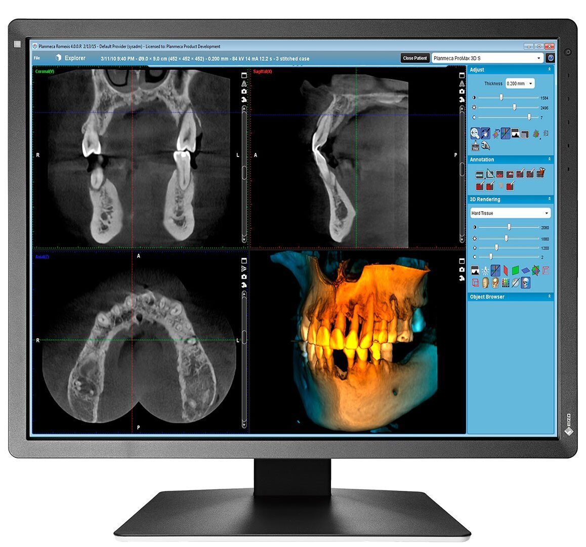 EIZO RadiForce MX216-HB Befundungsmonitor | 373557