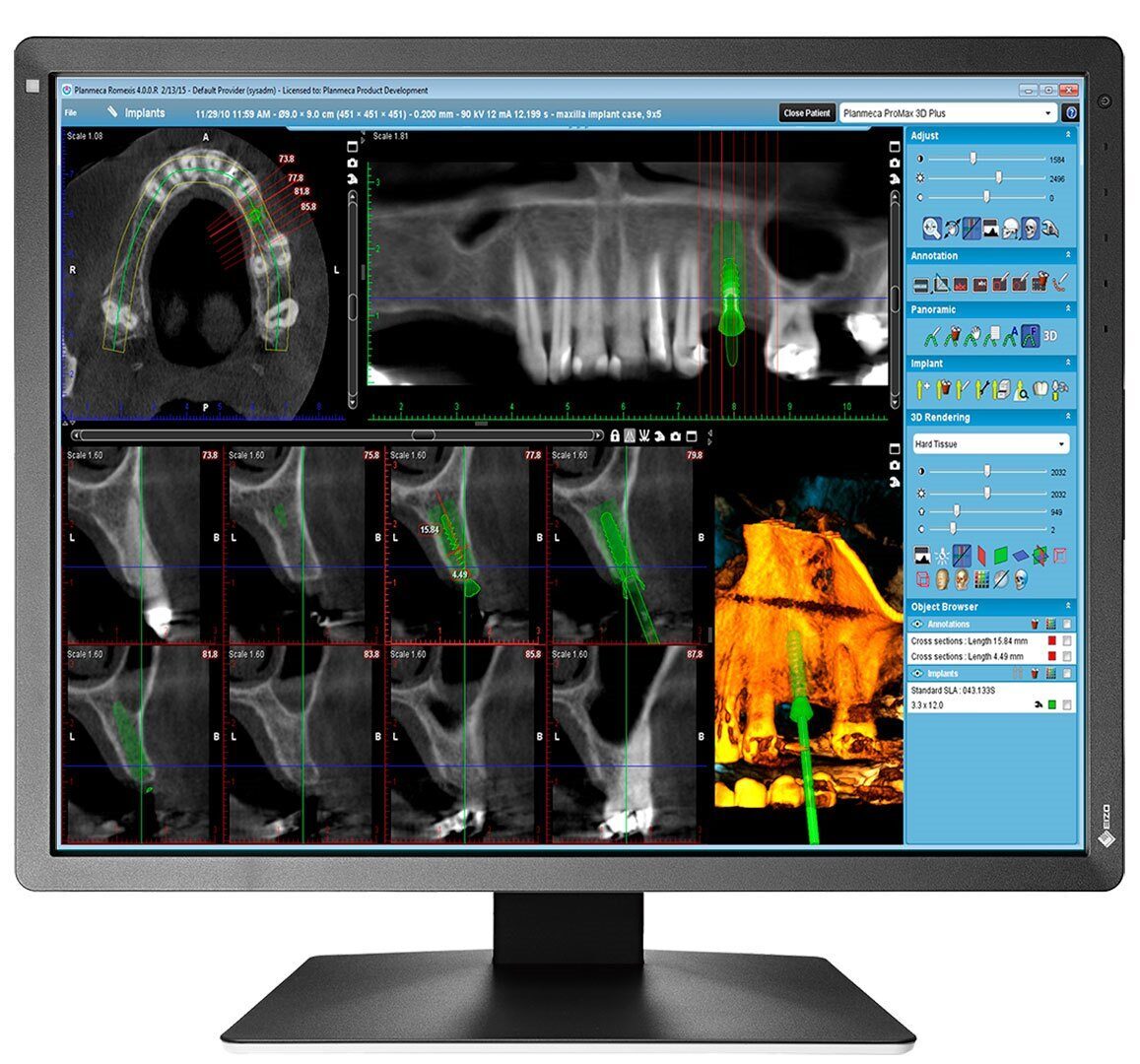 EIZO RadiForce MX217-SB Befundungsmonitor | 373559