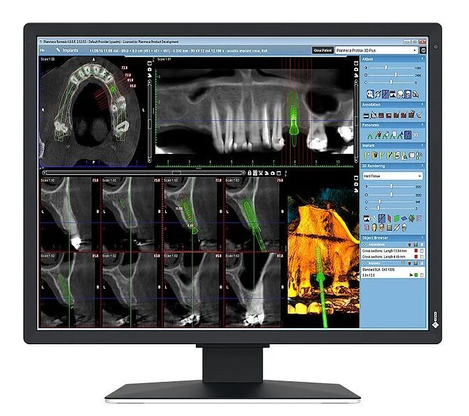EIZO RadiForce MX217-HB Befundungsmonitor | 373127