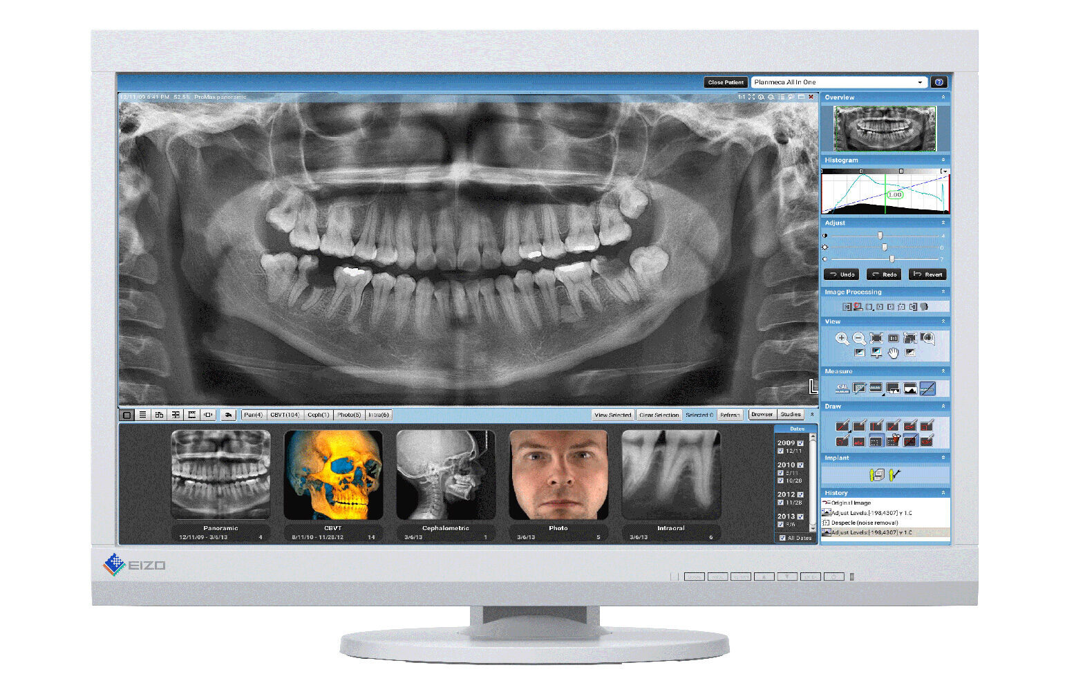 EIZO RadiForce MX232W-DT Befundungsmonitor | 373787