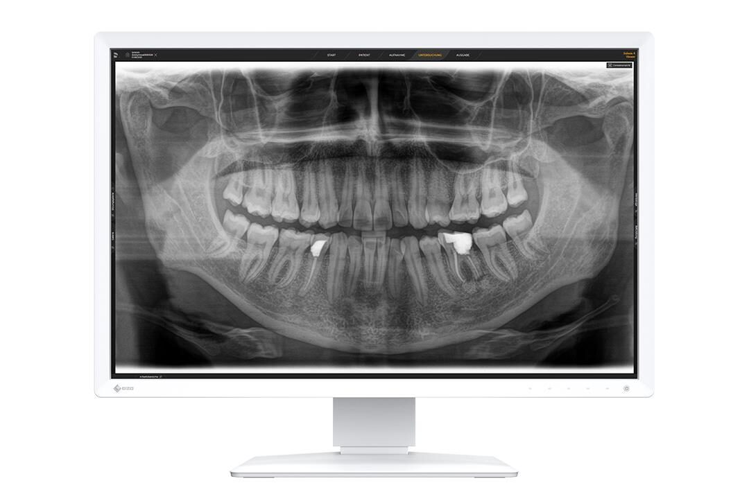 EIZO RadiForce MX243W-DT Befundungsmonitor | 372801