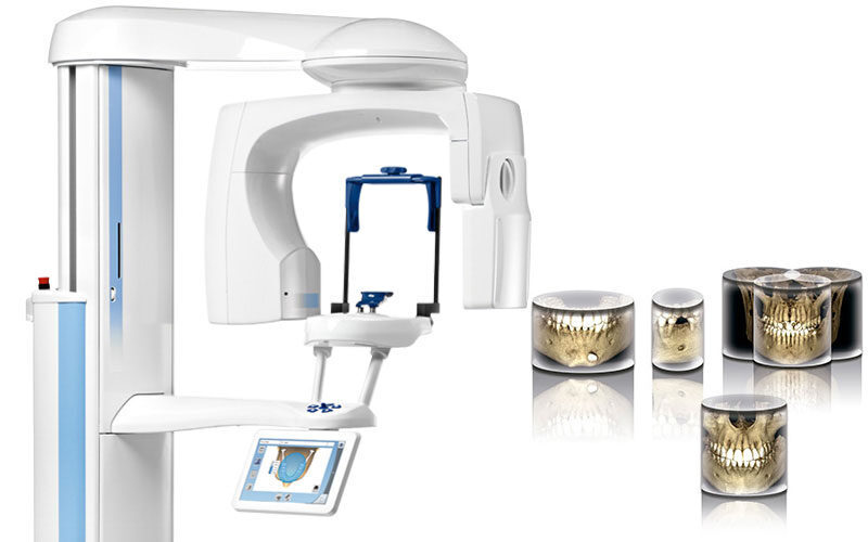 Planmeca Promax 3D Classic DVT Volumen 8×8 | 375253