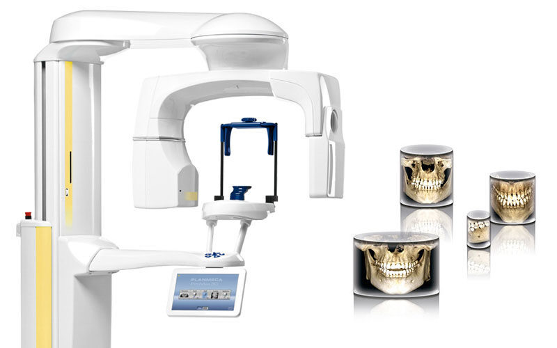 Planmeca ProMax 3D Plus DVT Volumen 20×10 | 375007