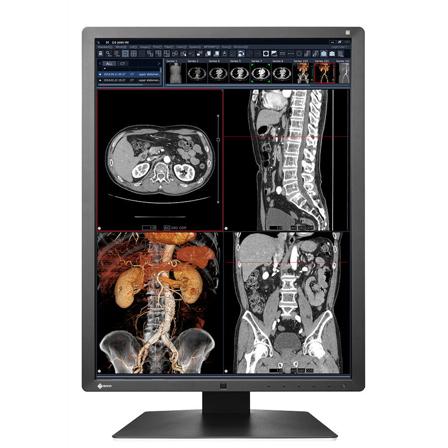 EIZO RadiForce RX250 Befundungsmonitor | 373747