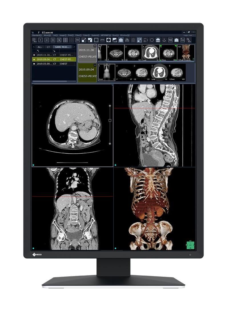 EIZO RadiForce RX270 Befundungsmonitor | 372791