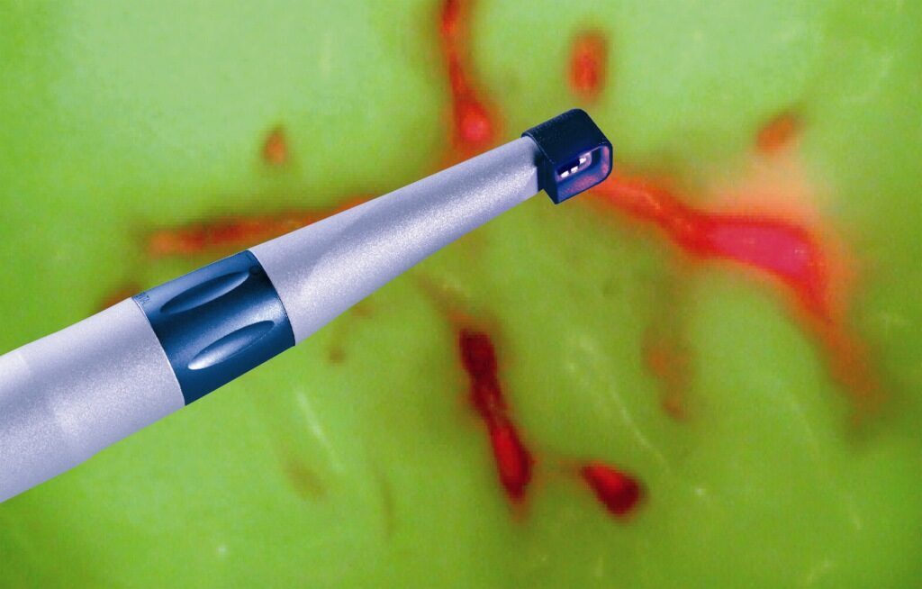 Dürr Vistaproof digitale Fluoreszenzkamera | 375629