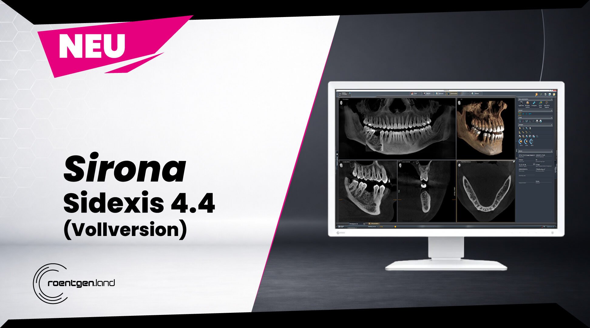 Sirona Sidexis 4.4 Vollversion | 382550
