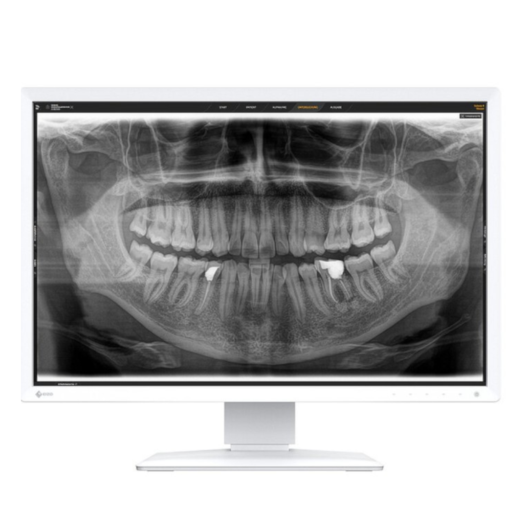 Dürr Dental VistaScan Combi Plus Speicherfolienscanner, gebraucht mit Befundungsmonitor & Workstation | 385093