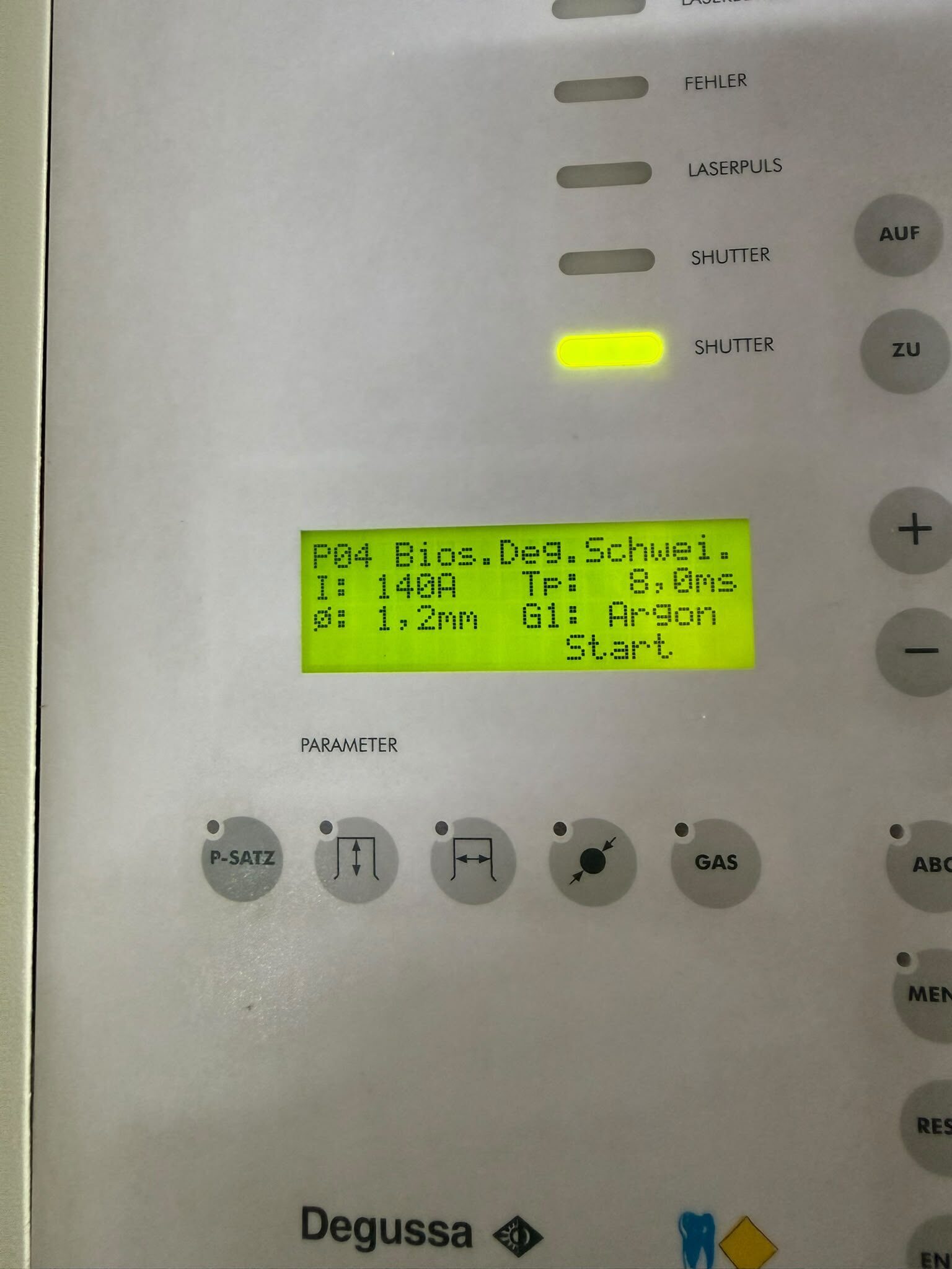 DeguDent Degussa Connexion Laser-Schweißgerät / Dental-Laser Rofin Sinar Labor | 385572