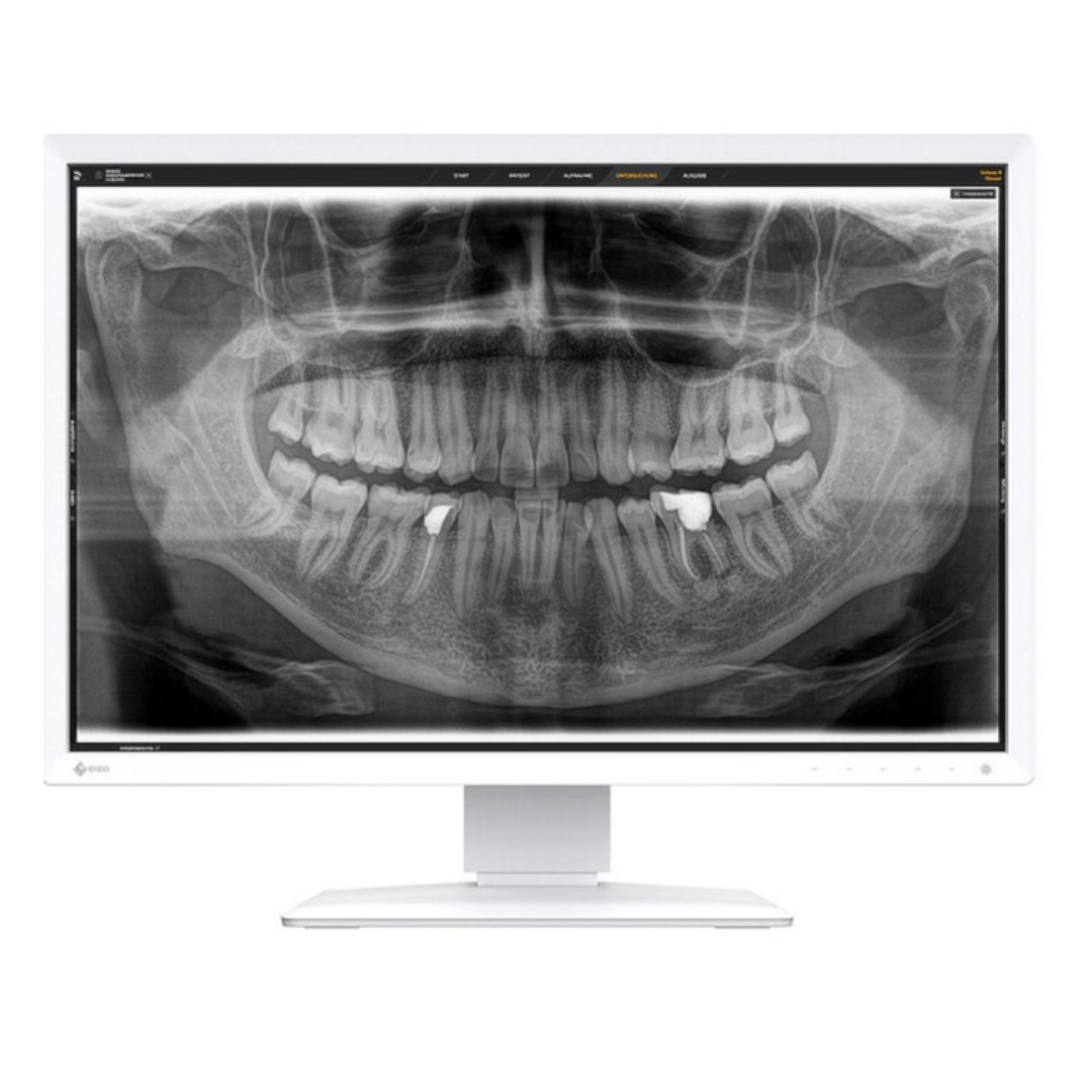 All Inclusive Röntgenpaket Digitalisierung Sirona Orthophos XG3 / XG Plus / XG5 + Dürr VistaScan Mini View 2.0 + Röntgen-PC + Befundungsmonitor + Montage + Abnahme + 12 Mon. Gewährleistung | 384760