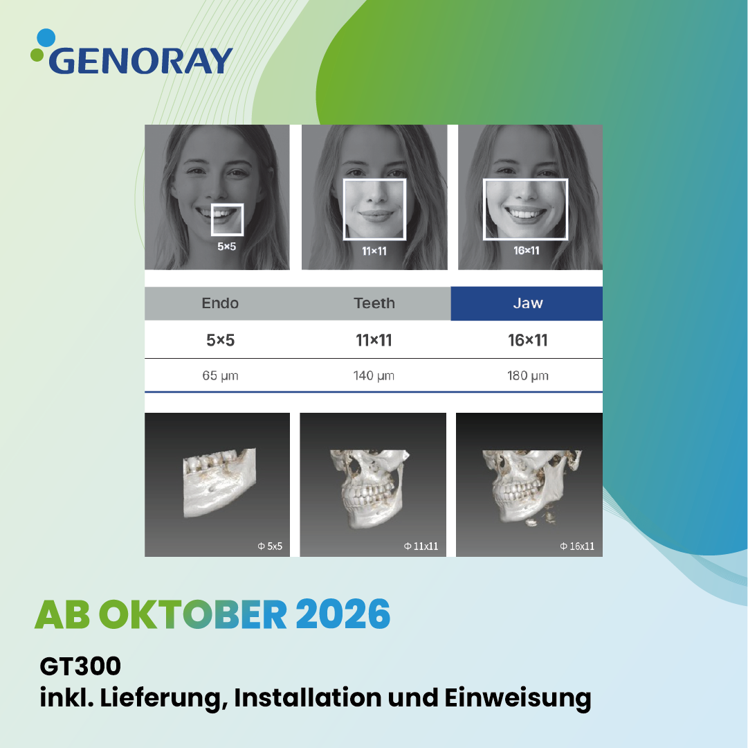 GENORAY GT300 – NEUGERÄT – Erhältlich ab Oktober 2026 – 65 µm – sehr hohe Auflösung | 384672