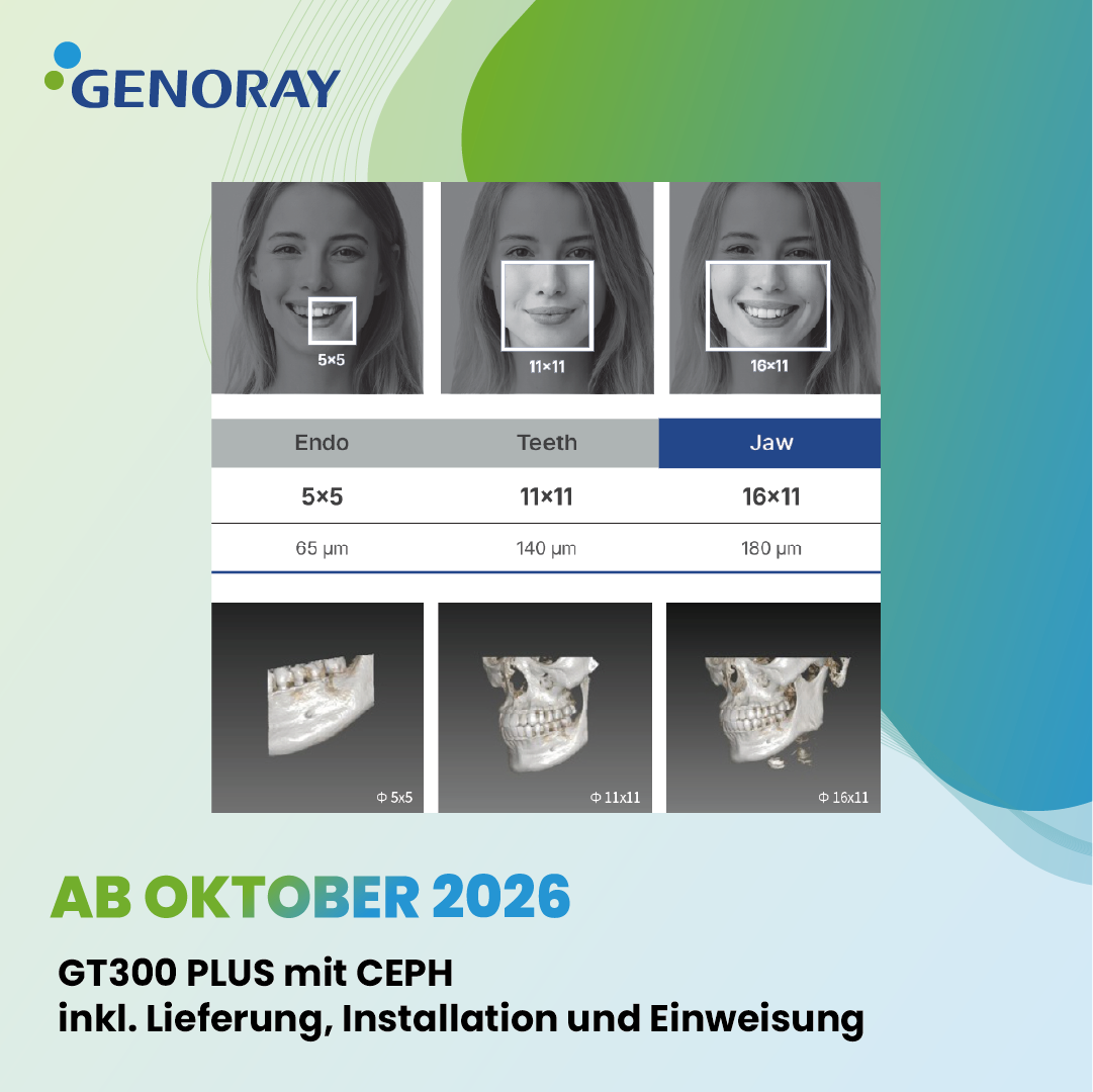 GENORAY GT300 PLUS (Ceph) – NEUGERÄT – Erhältlich ab Oktober 2026 – 65 µm – sehr hohe Auflösung | 384677