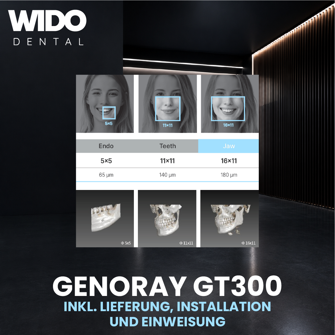 GENORAY GT300 – !NEU! – Erhältlich ab Oktober 2026 – NEUGERÄT – 65 µm – sehr hohe Auflösung | 384653