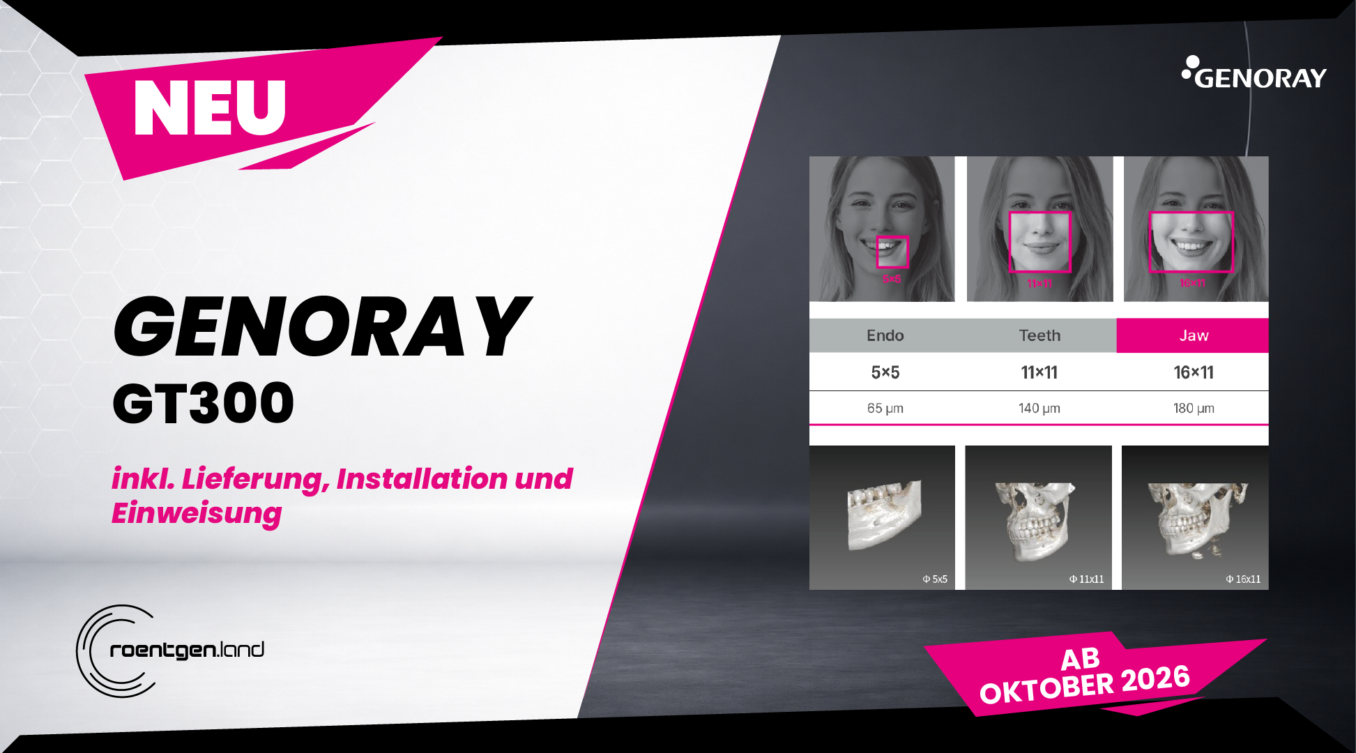 GENORAY GT300 – !NEU! – Erhältlich ab Oktober 2026 – NEUGERÄT – 65 µm – sehr hohe Auflösung | 384683