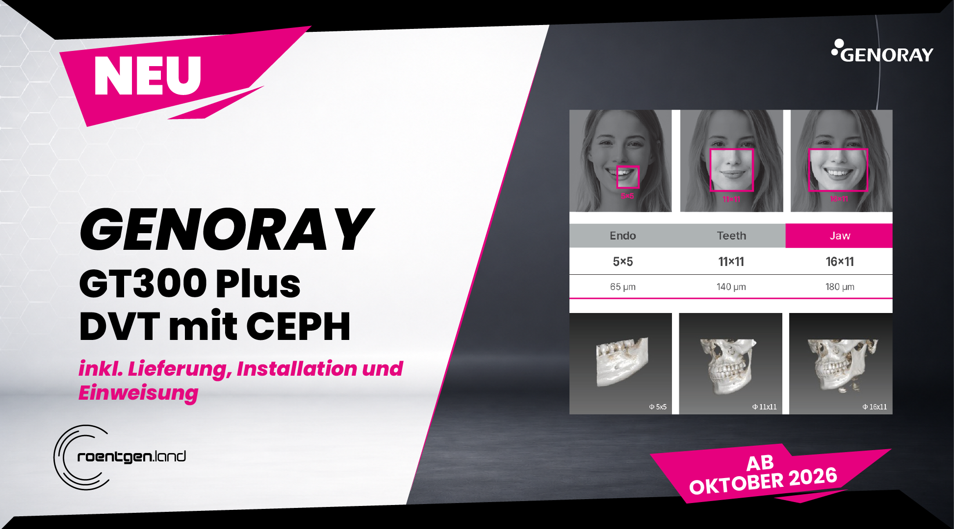 GENORAY GT300 PLUS (Ceph) – !NEU! – Erhältlich ab Oktober 2026 – NEUGERÄT – 65 µm – sehr hohe Auflösung | 384689