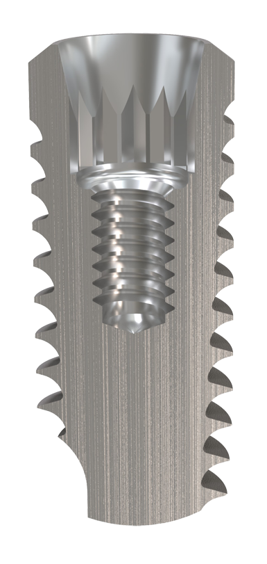 Cumdente Prio Plus Implant | 410339