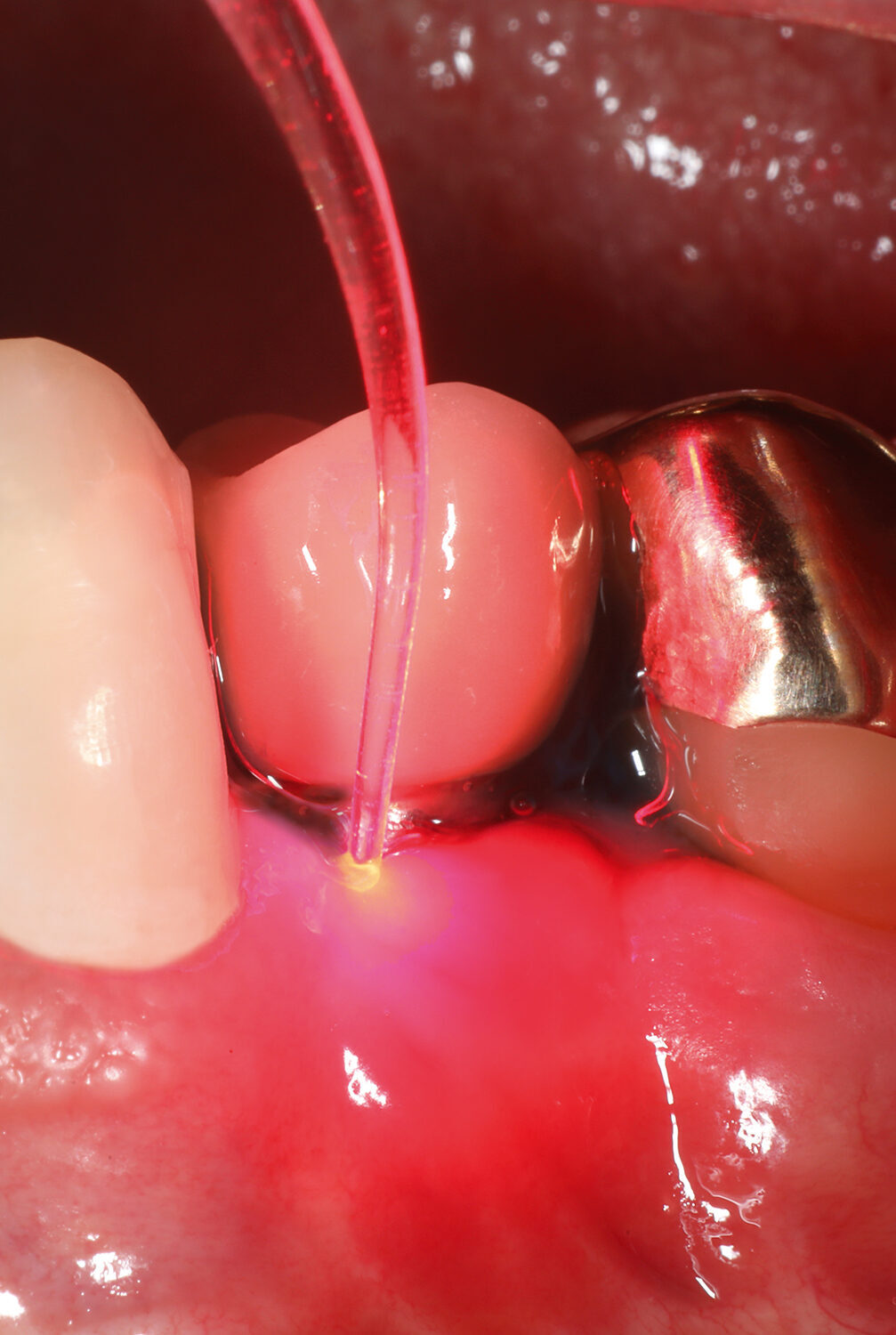 Cumdente PACT 600 | 410396