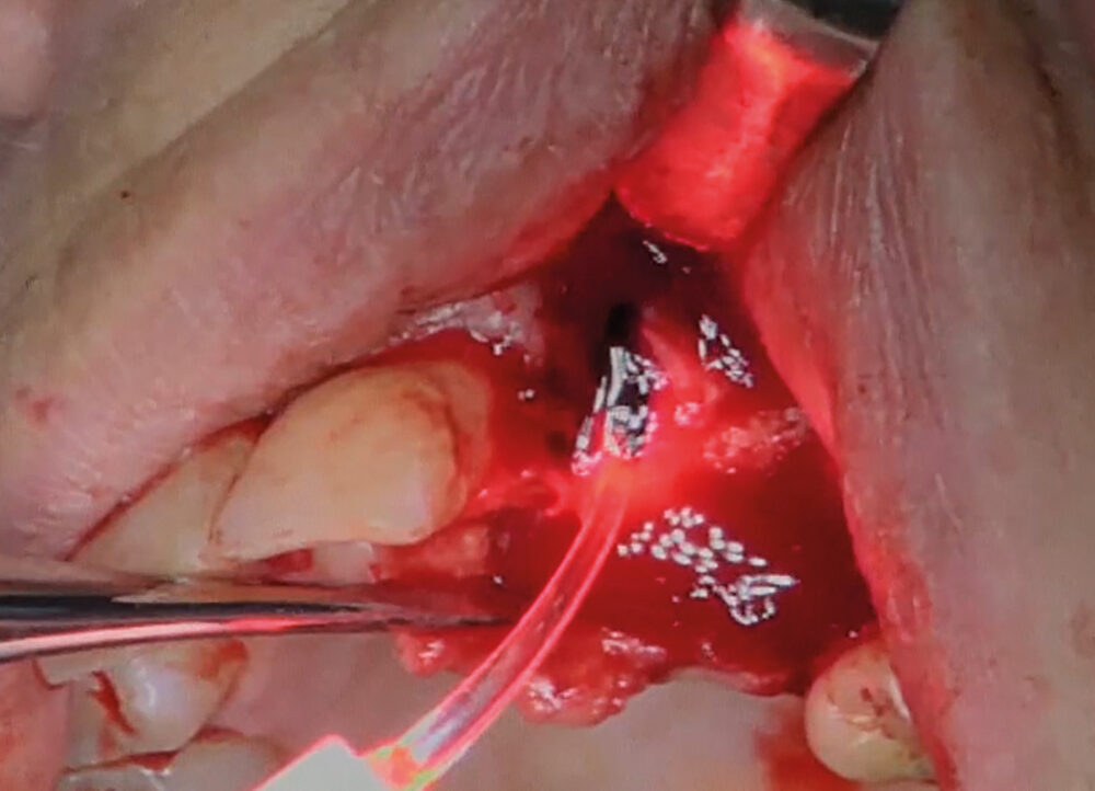 Cumdente PACT 600 | 410397