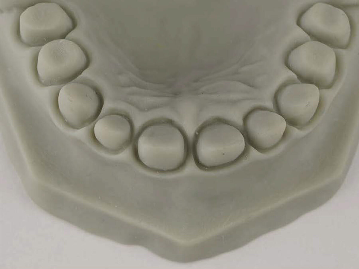 CRS Ortho Model Resin gray (1000g) | 425782