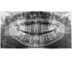 Dentsply Sirona Orthophos E mit Ceph links (2 Sensoren) | 434215
