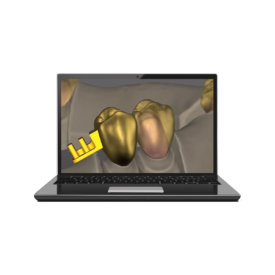 Schütz Dental Tizian Creativ RT-Software