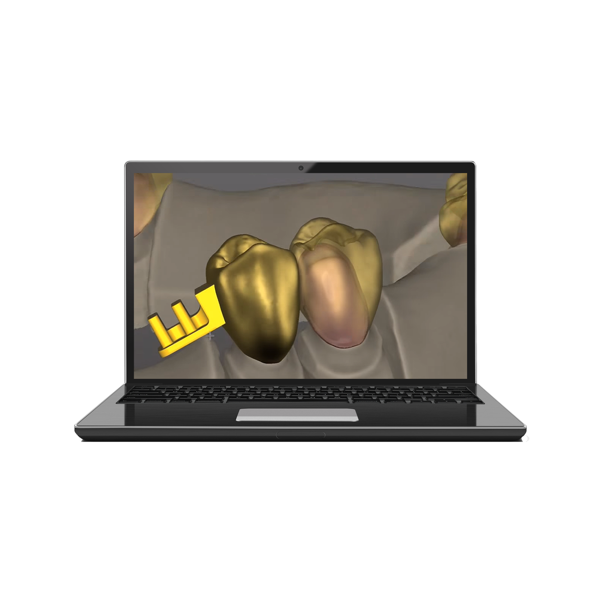 Schütz Dental Tizian Creativ RT-Software | 429320