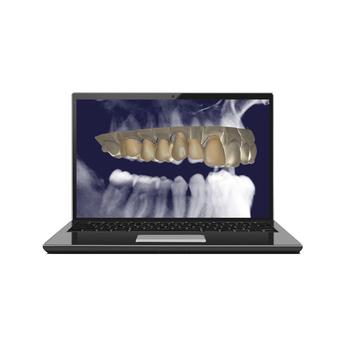 Schütz Dental Tizian Creativ RT DICOMViewer | 429296