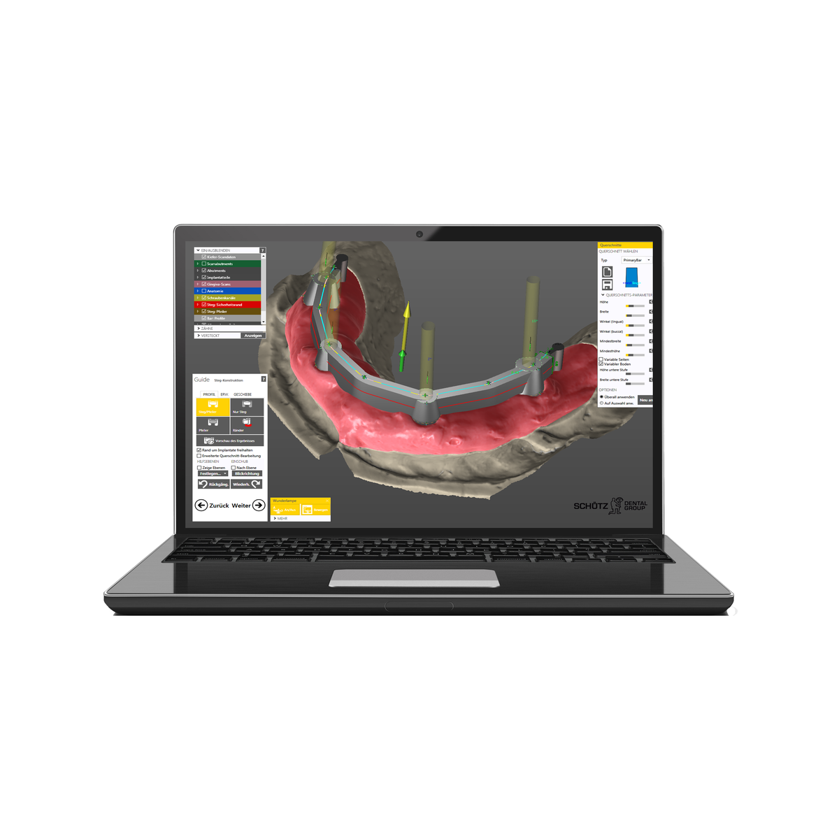 Schütz Dental Tizian Creativ RT Stegmodul | 429294