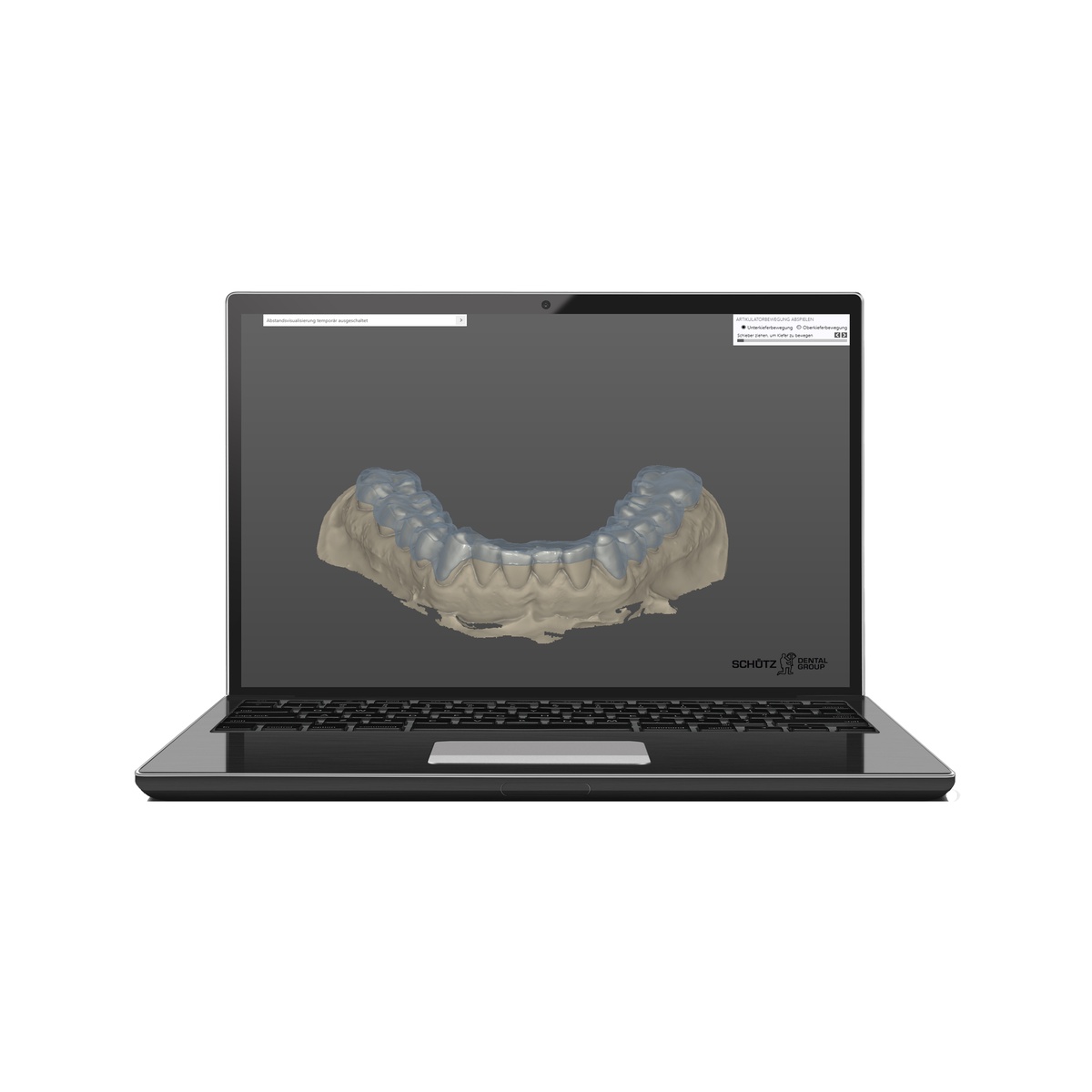 Schütz Dental Tizian Creativ RT Schienen-Tool | 429292