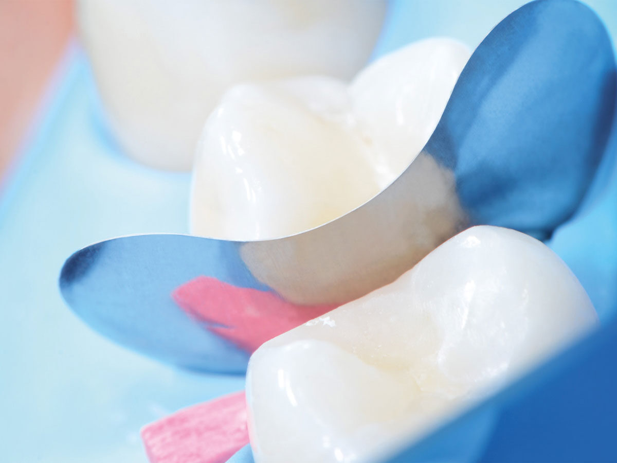QuickmatFLEX Teilmatrizen, Prämolar (100) | 422642