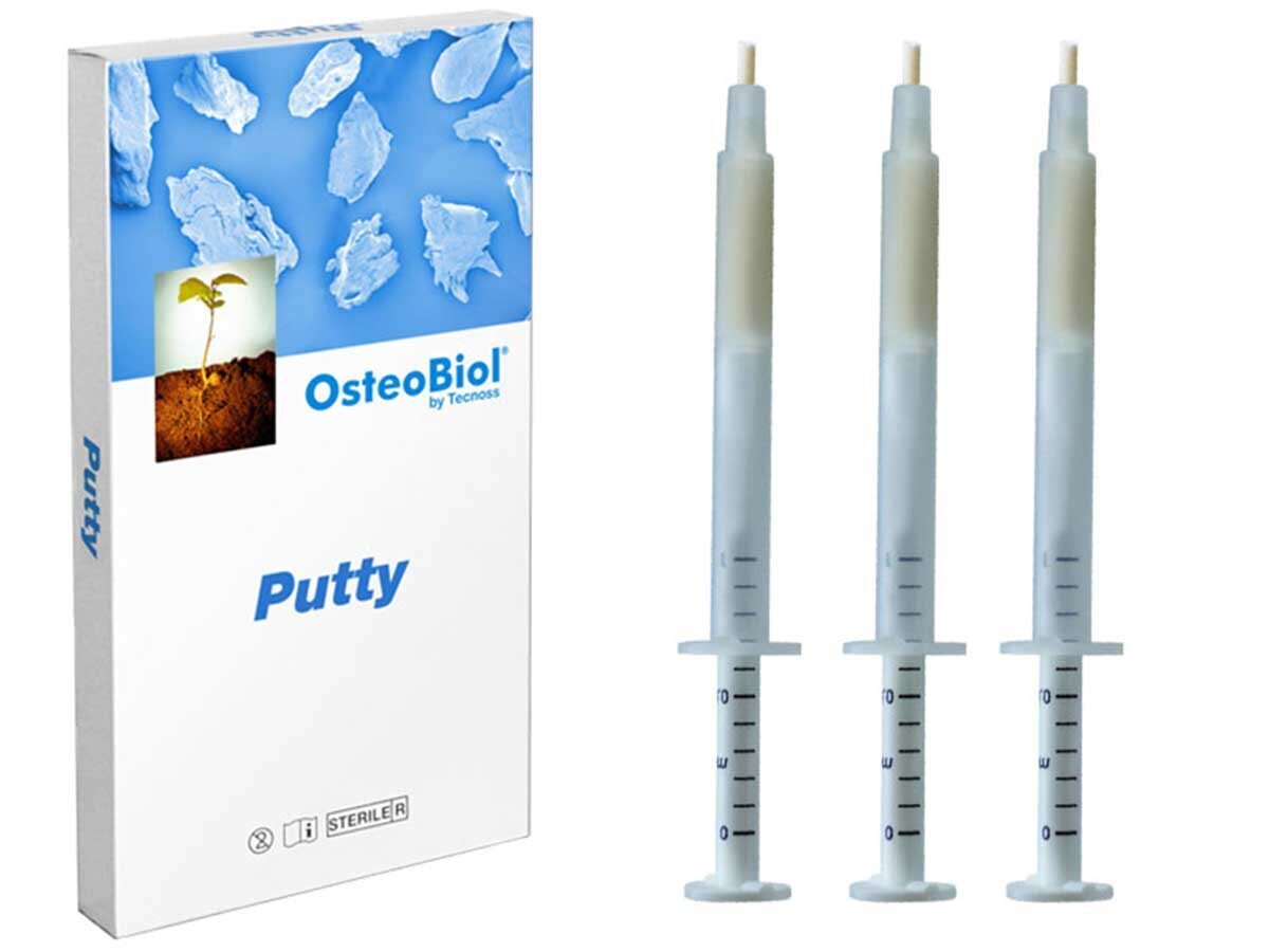 Putty Porcine (3×0,5 cc Spritze) | 422828