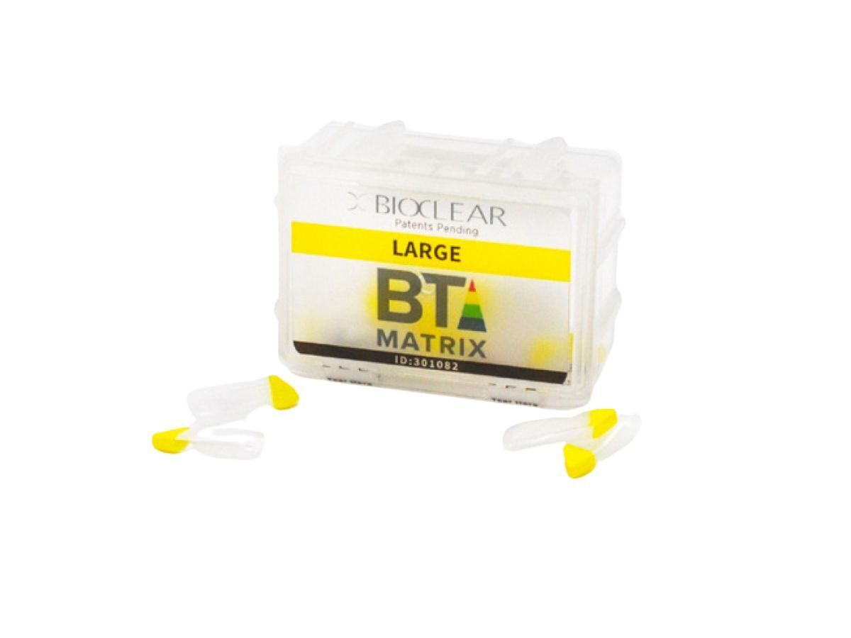 Black Triangle Matrix Large Yellow – 75 µm (20) | 423320
