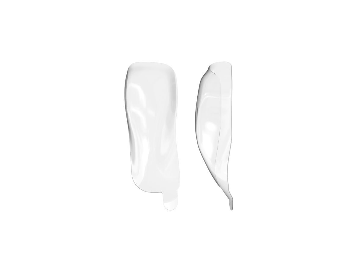 HD Anterior Matrix A-series Shapes, 75µm, A102 – Upper Distal (50) | 423394