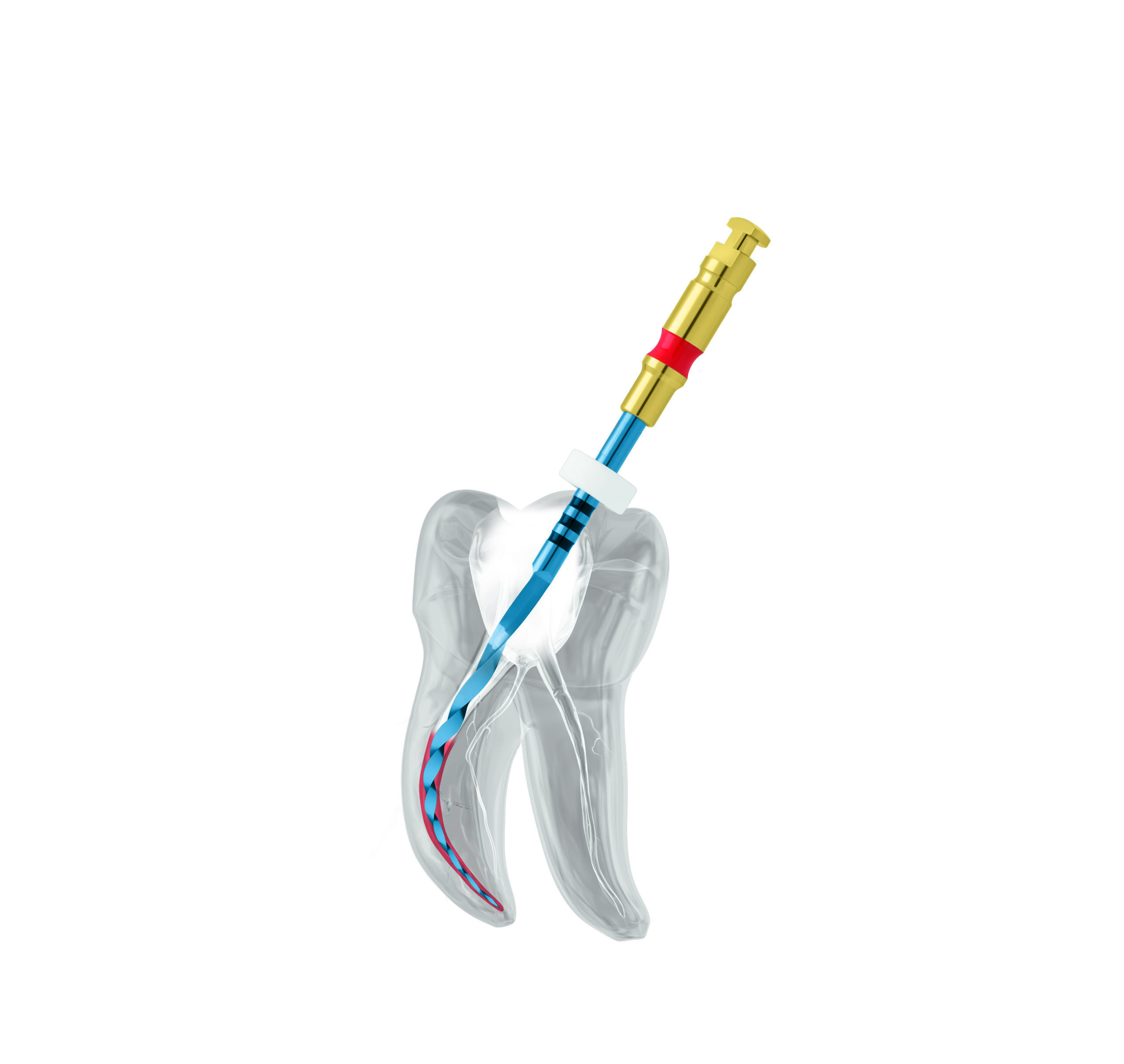 Cumdente CD-highflex File Unicone Plus Set | 410303