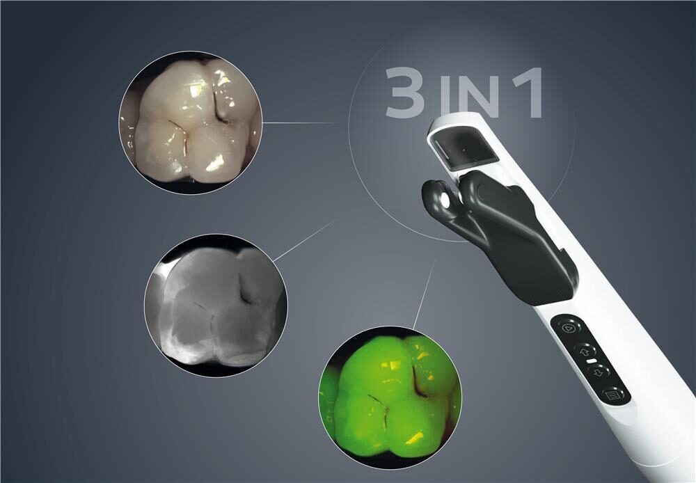 KaVo DIAGNOcam Vision Full HD  3-in-1 Rundum-Diagnostik | 407542