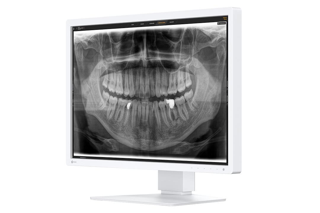 EIZO RadiForce MX243W-DT Befundungsmonitor | 407023