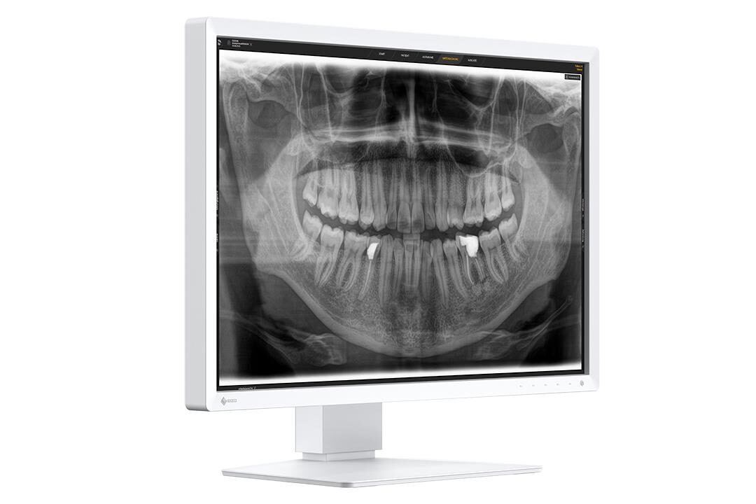 EIZO RadiForce MX243W-DT Befundungsmonitor | 407024