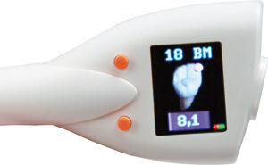 Orangedental Pa-On Parometer | 409231