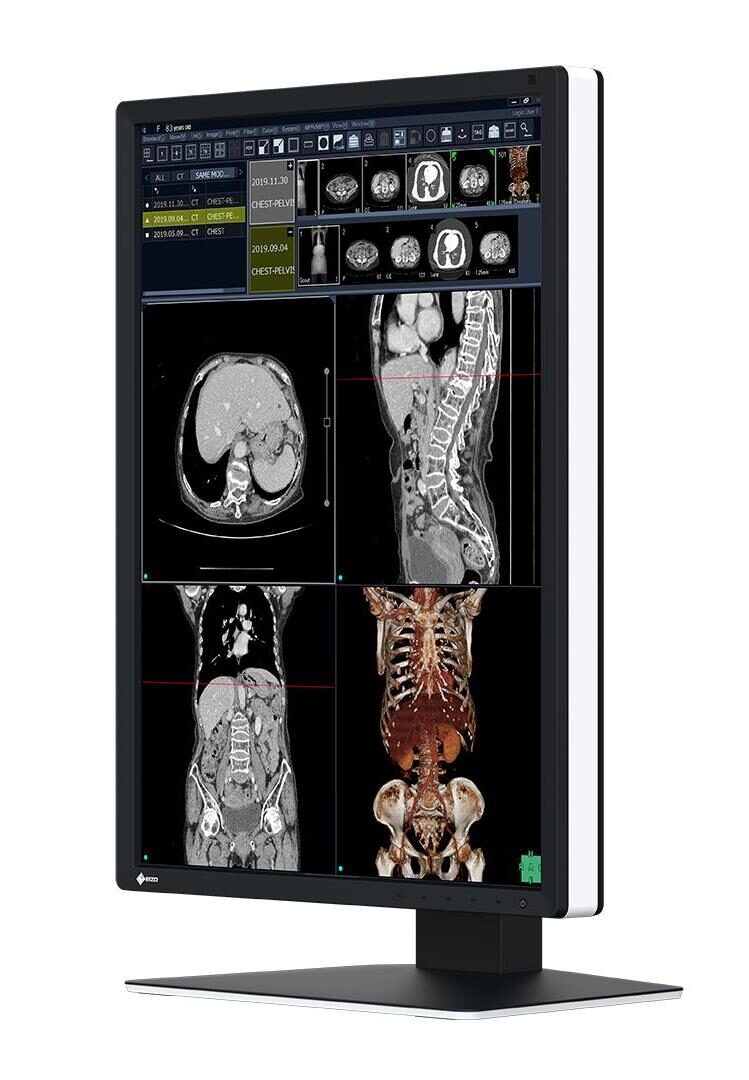 EIZO RadiForce RX270 Befundungsmonitor | 407003